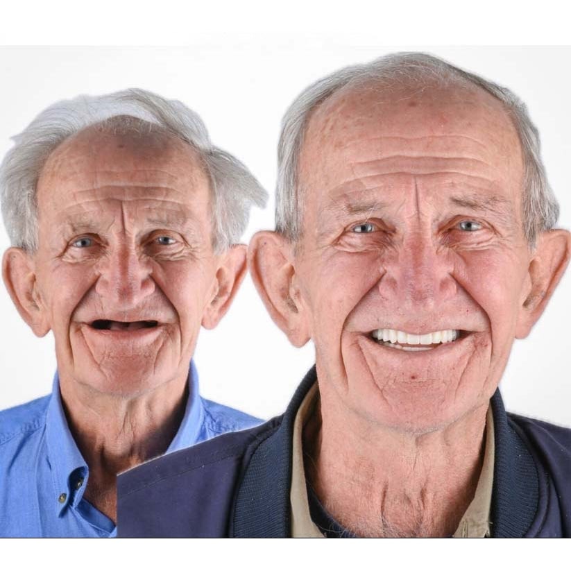 Men's Removable Dentures with Flexible Cushion Grip Storage Case and Realistic Upper Lower Arches - Image 12