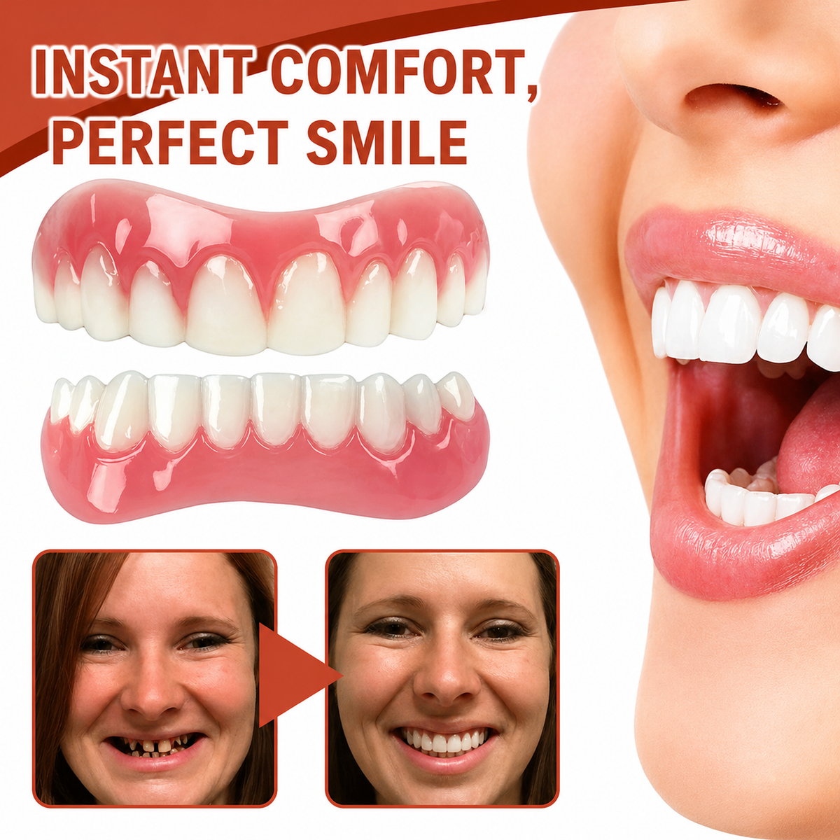 Snap on Veneers Temporary Moldable Fake Teeth Upper and Lower Set with Simulated Gums - Image 1