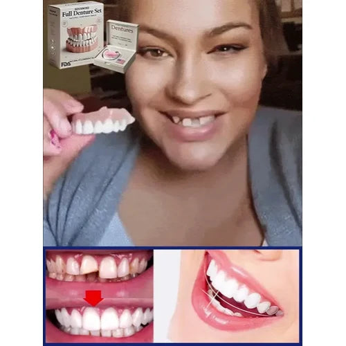 Snap on Veneers Upper and Lower Teeth with Moldable Cosmetic Resin and Adjustable Fit - Image 8